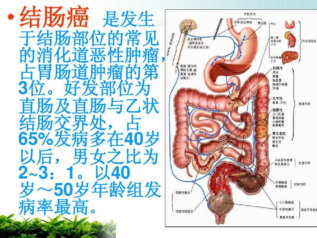 入院后保守治疗肠梗阻缓解后做肠镜检查,结果发现结肠有新生物,环绕肠