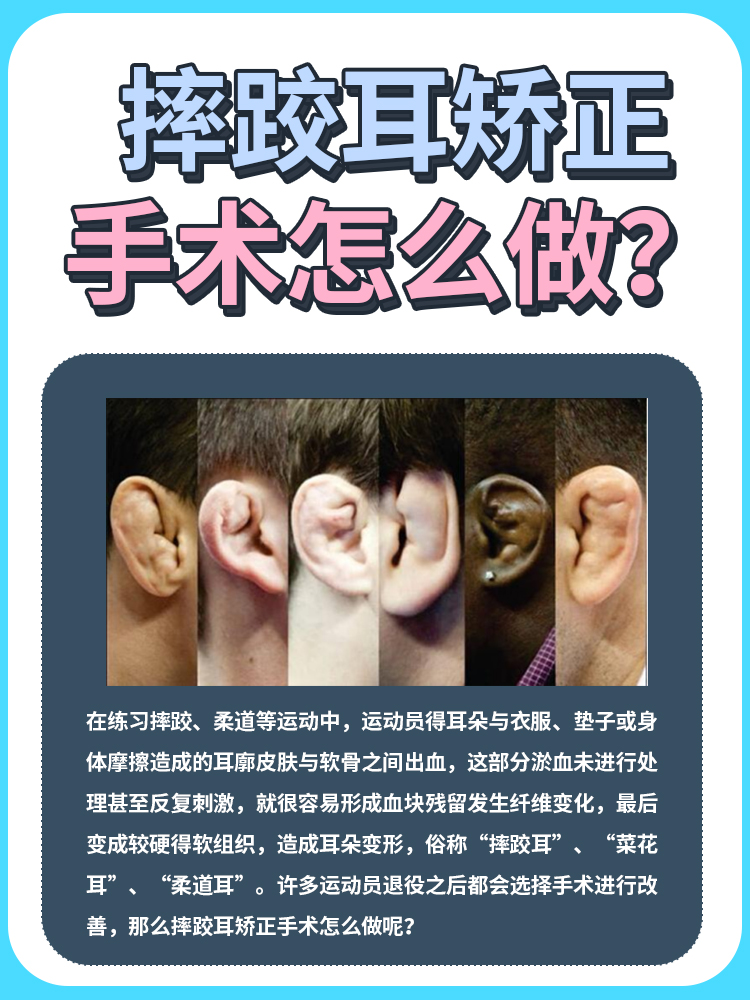 摔跤运动员常见的摔跤耳应该怎么治疗