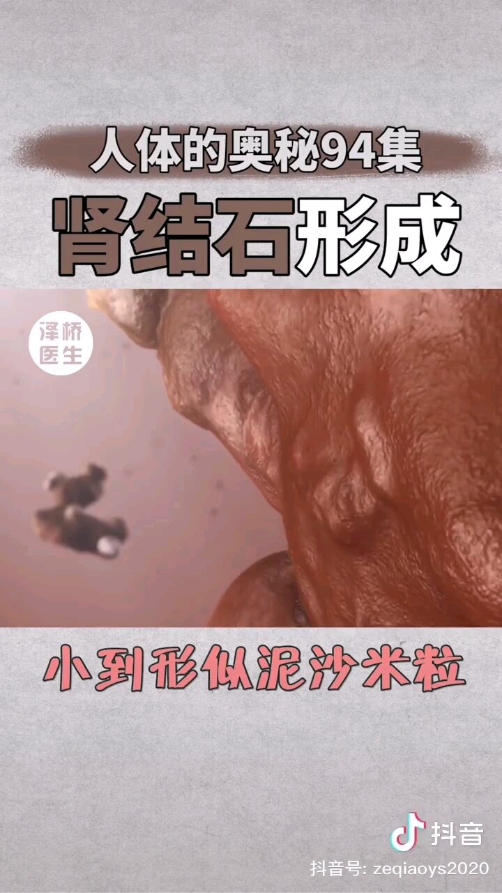 默认图片