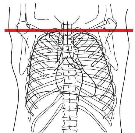 sternothyroid muscle 胸骨甲状肌6.