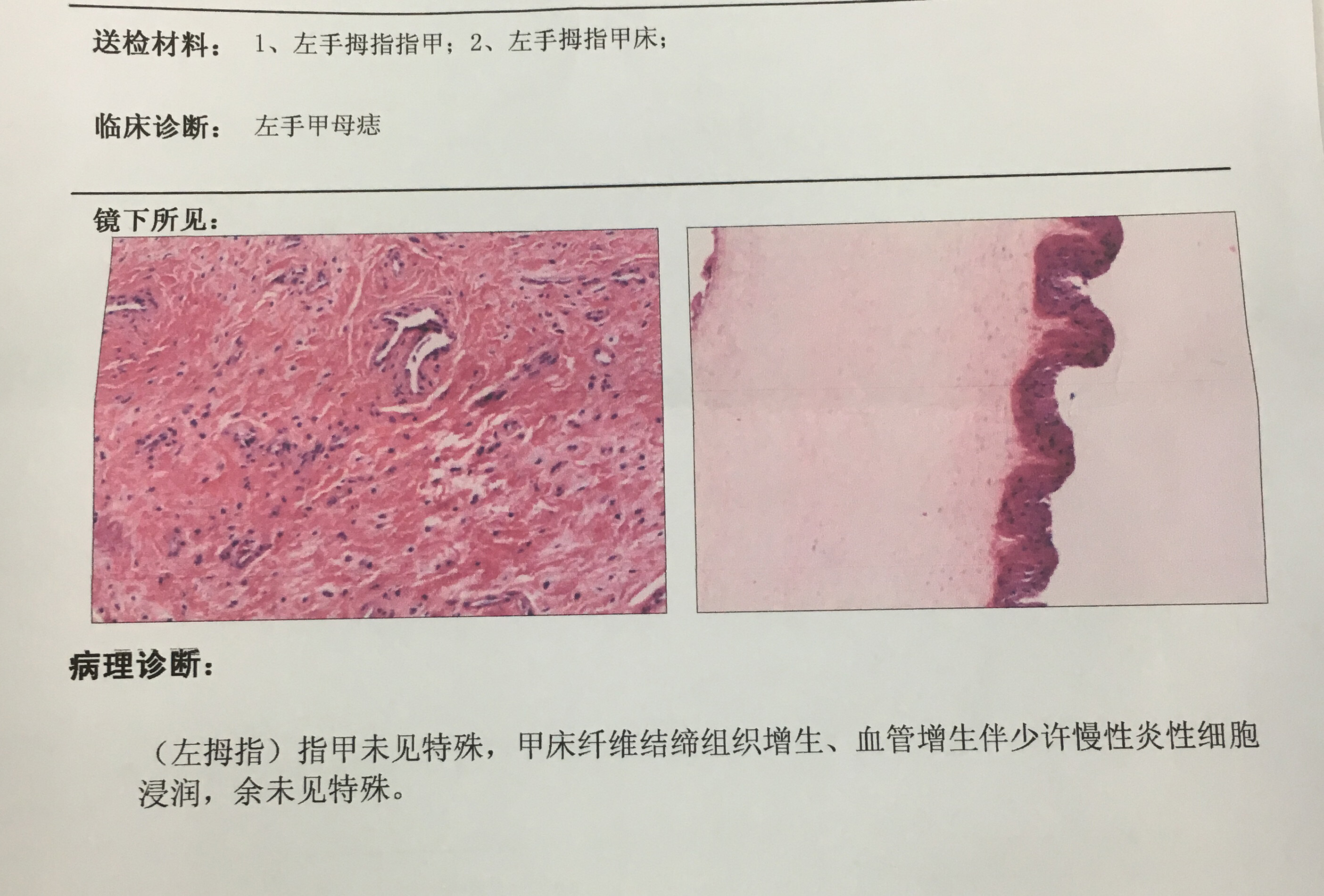 甲母细胞图片