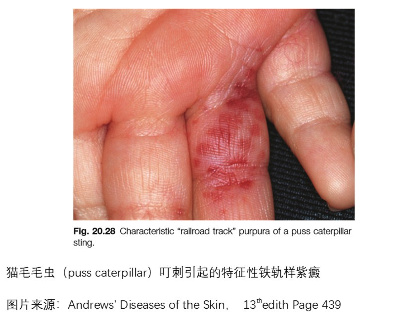 这是被什么虫子咬的呀？！ - 好大夫在线