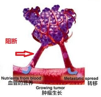 抗血管生成示意图.jpg