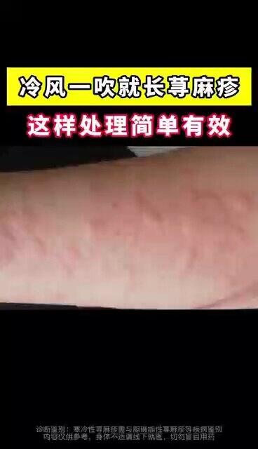 視頻封面