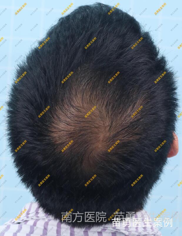 圖文圖片