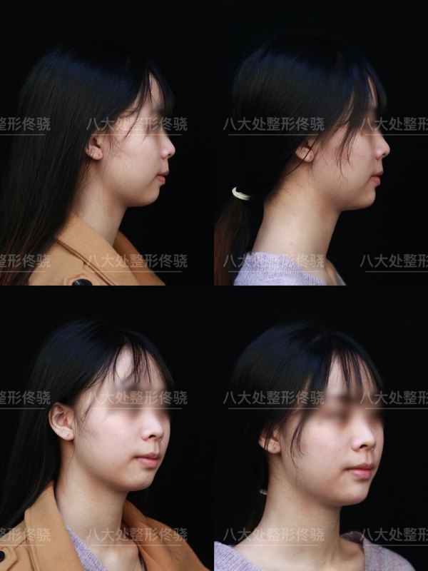 圖文圖片