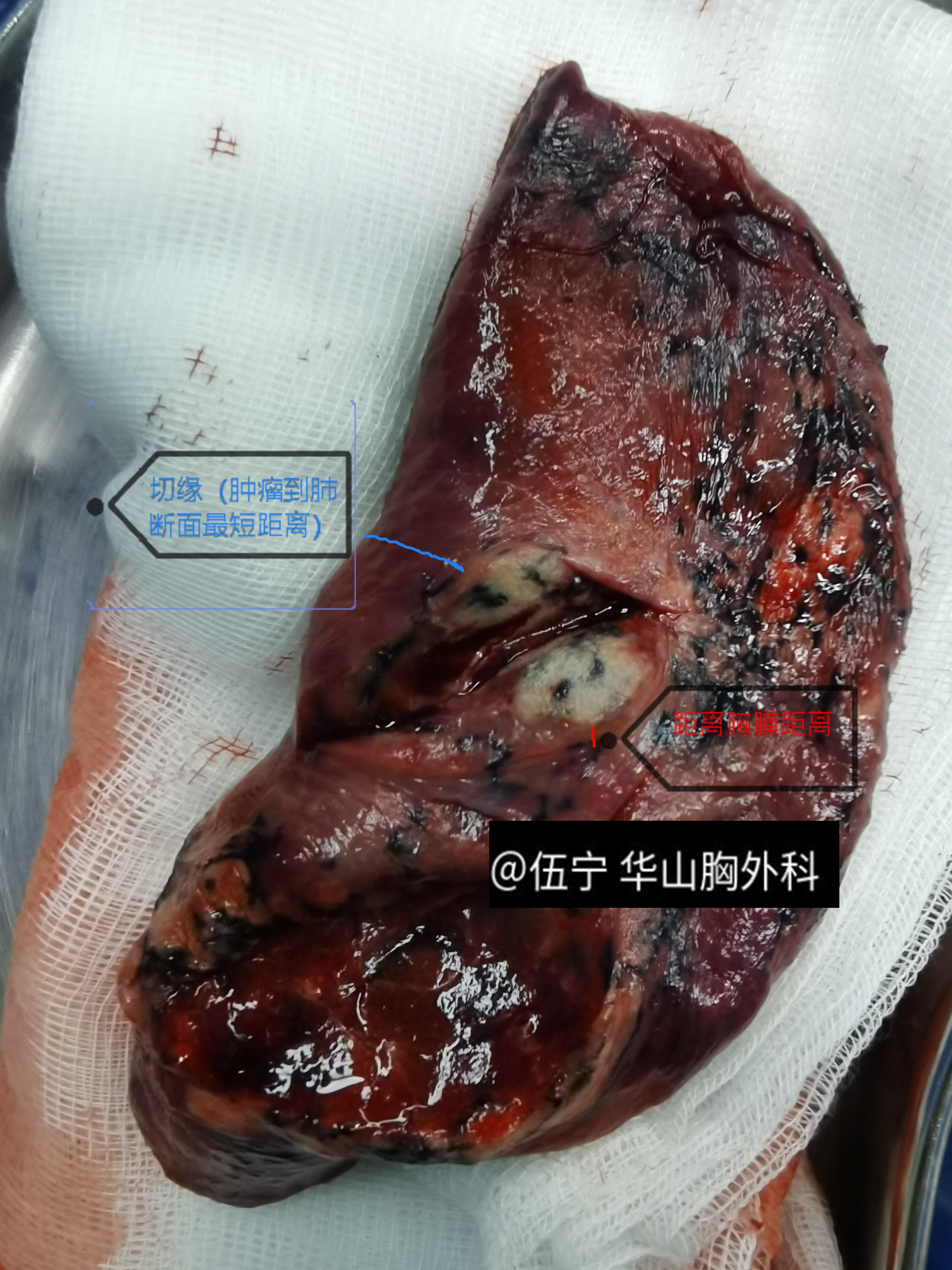 嘶声裂肺的意思 14YBAGJjYauAVj-IACI-YvPTNyg786.jpg?_ms_=5fea