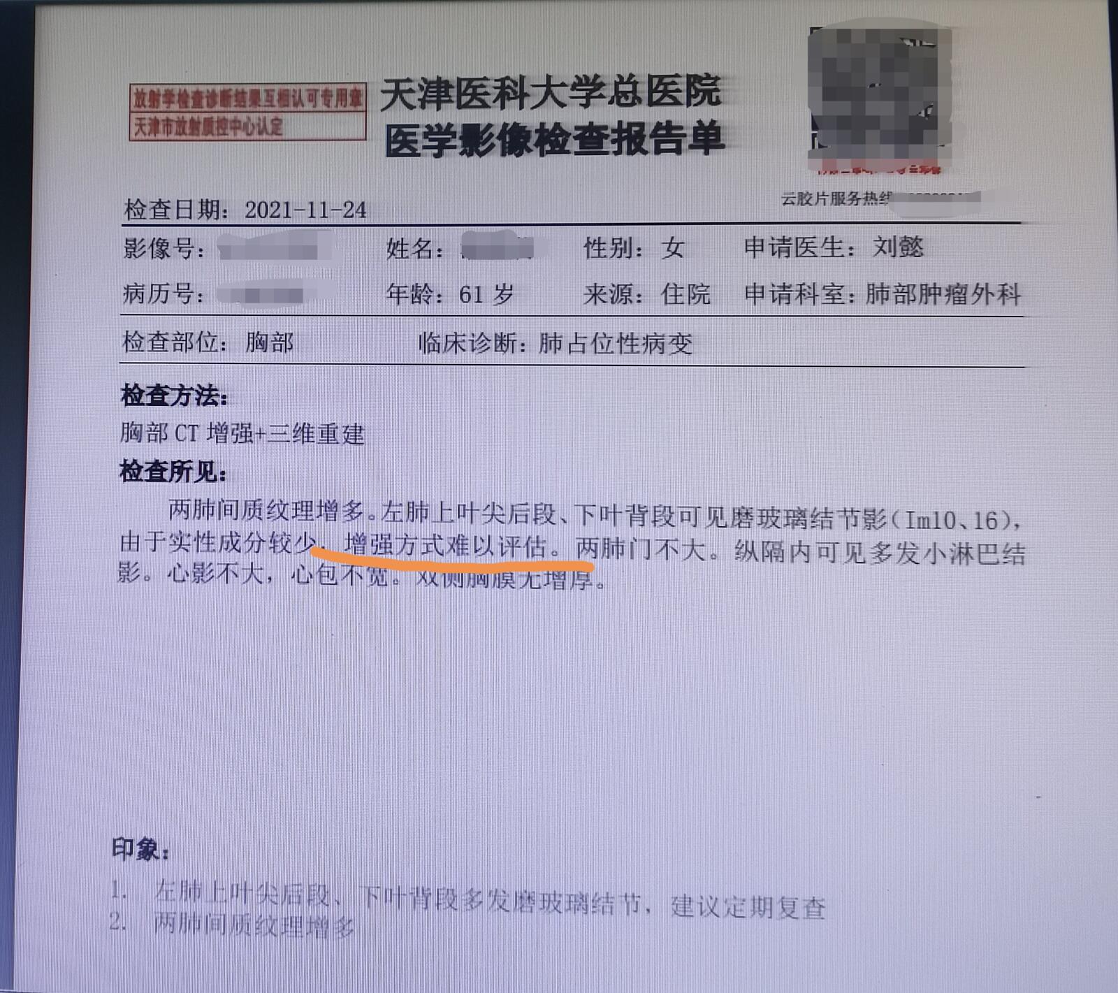 肺部良性肿瘤ct报告图片