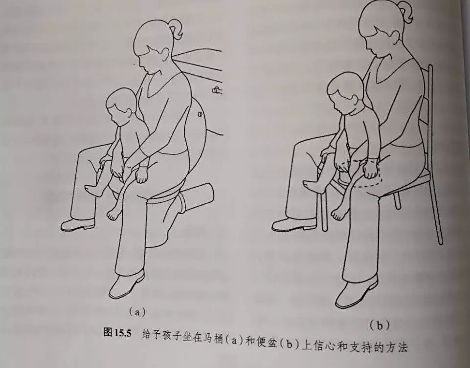 对于站立困难的患儿,可以训练其应用膝立位独立完成排便动作.