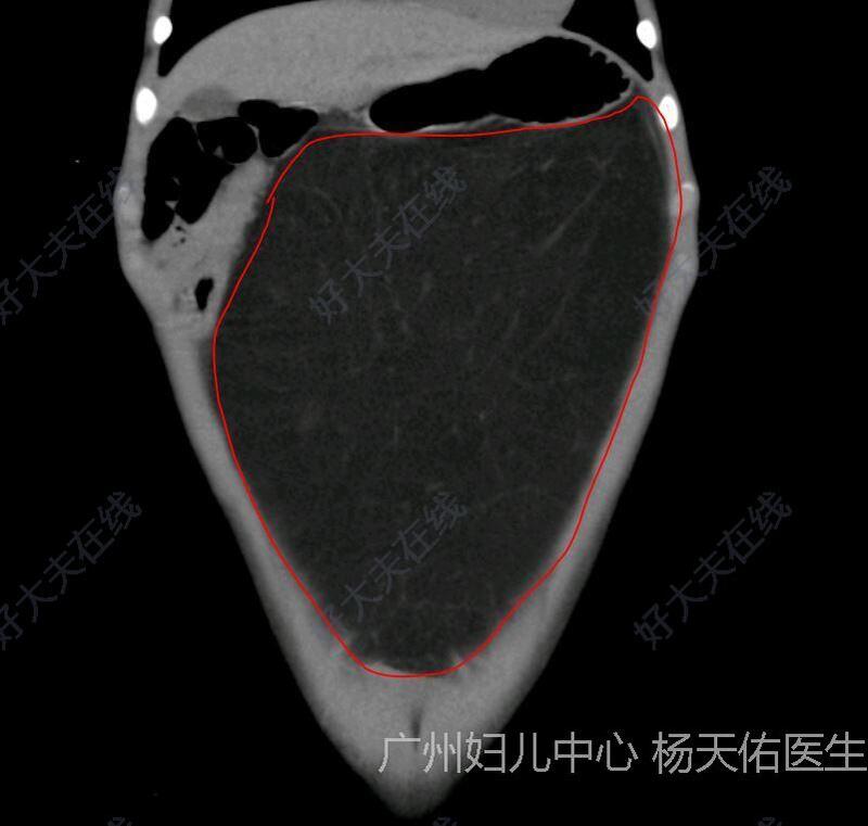 圖文圖片