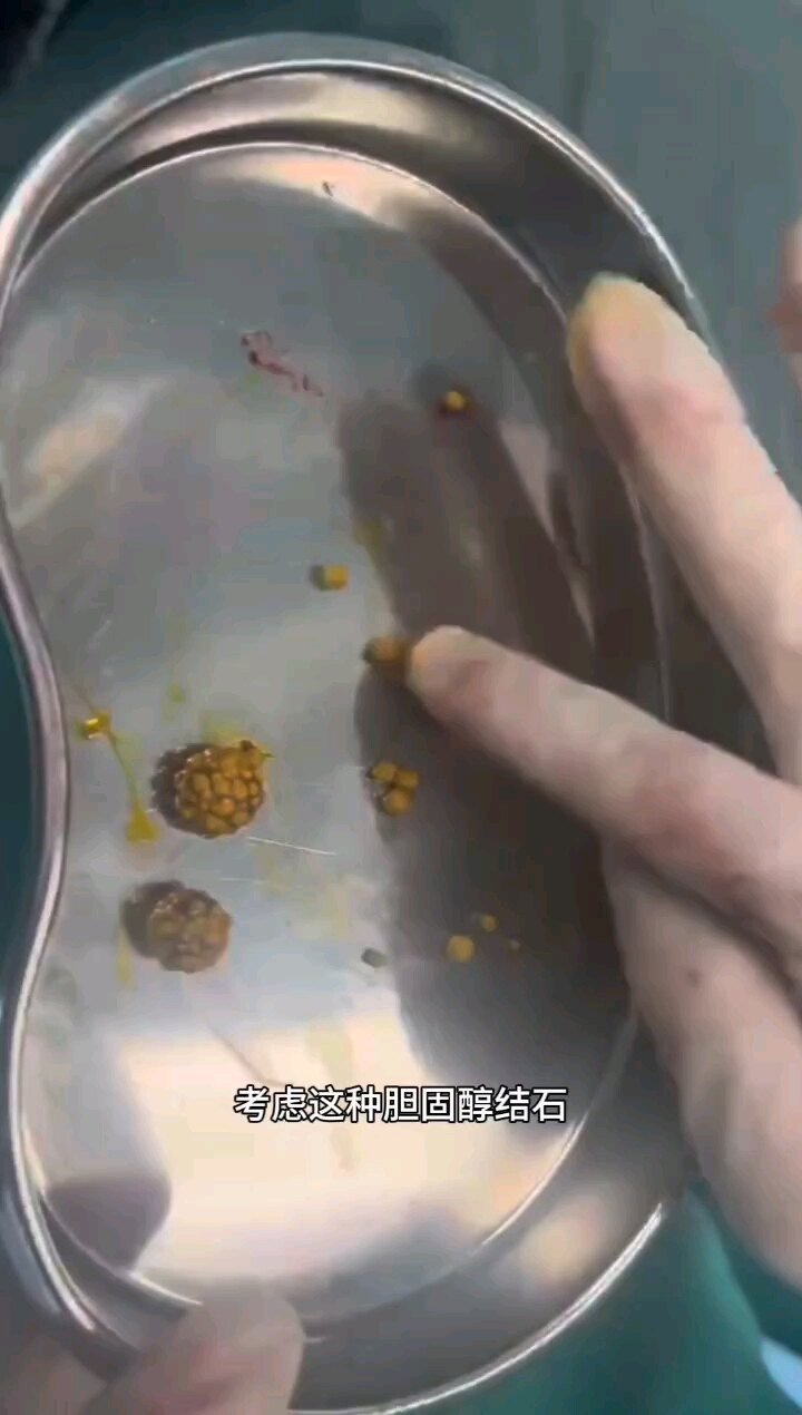 默认图片