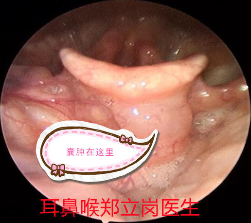 圖文圖片
