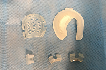 小儿先天性耳廓畸形无创矫正