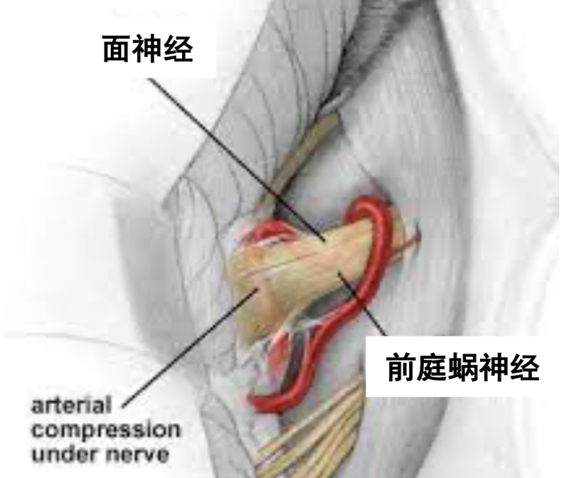 圖文圖片