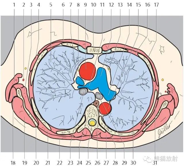 thoracodorsal artery 胸背動脈3. subscapularis muscle 肩胛下 4..