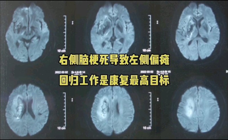 視頻封面
