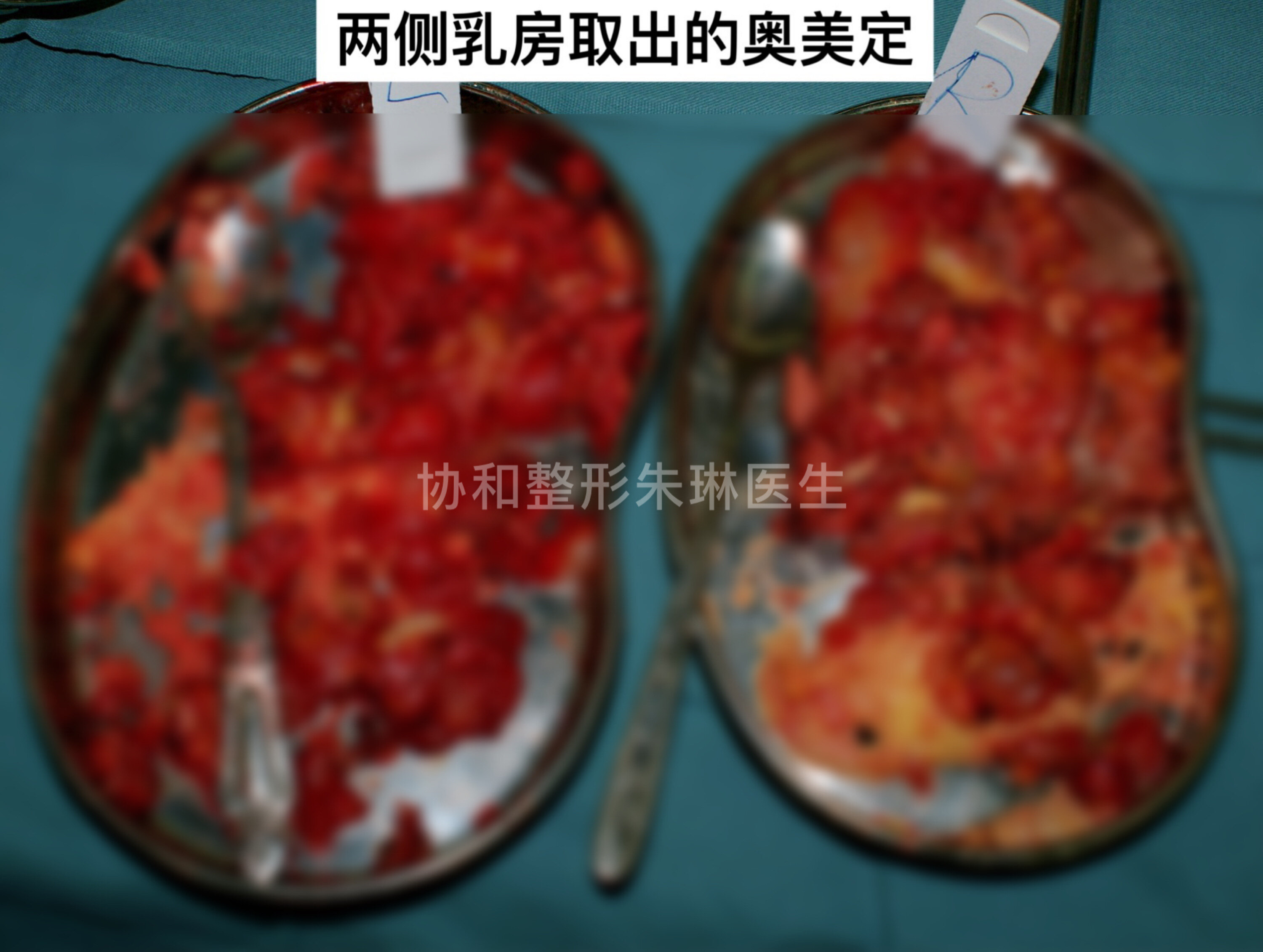 圖文圖片