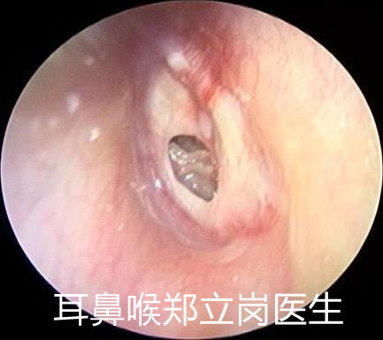 圖文圖片