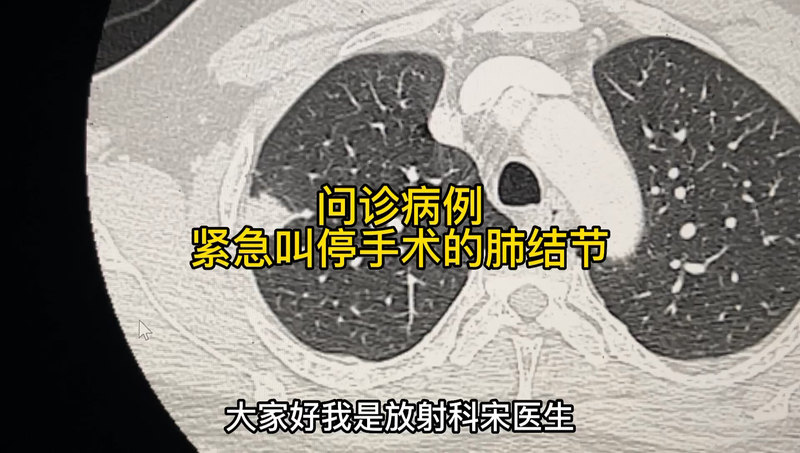 視頻封面