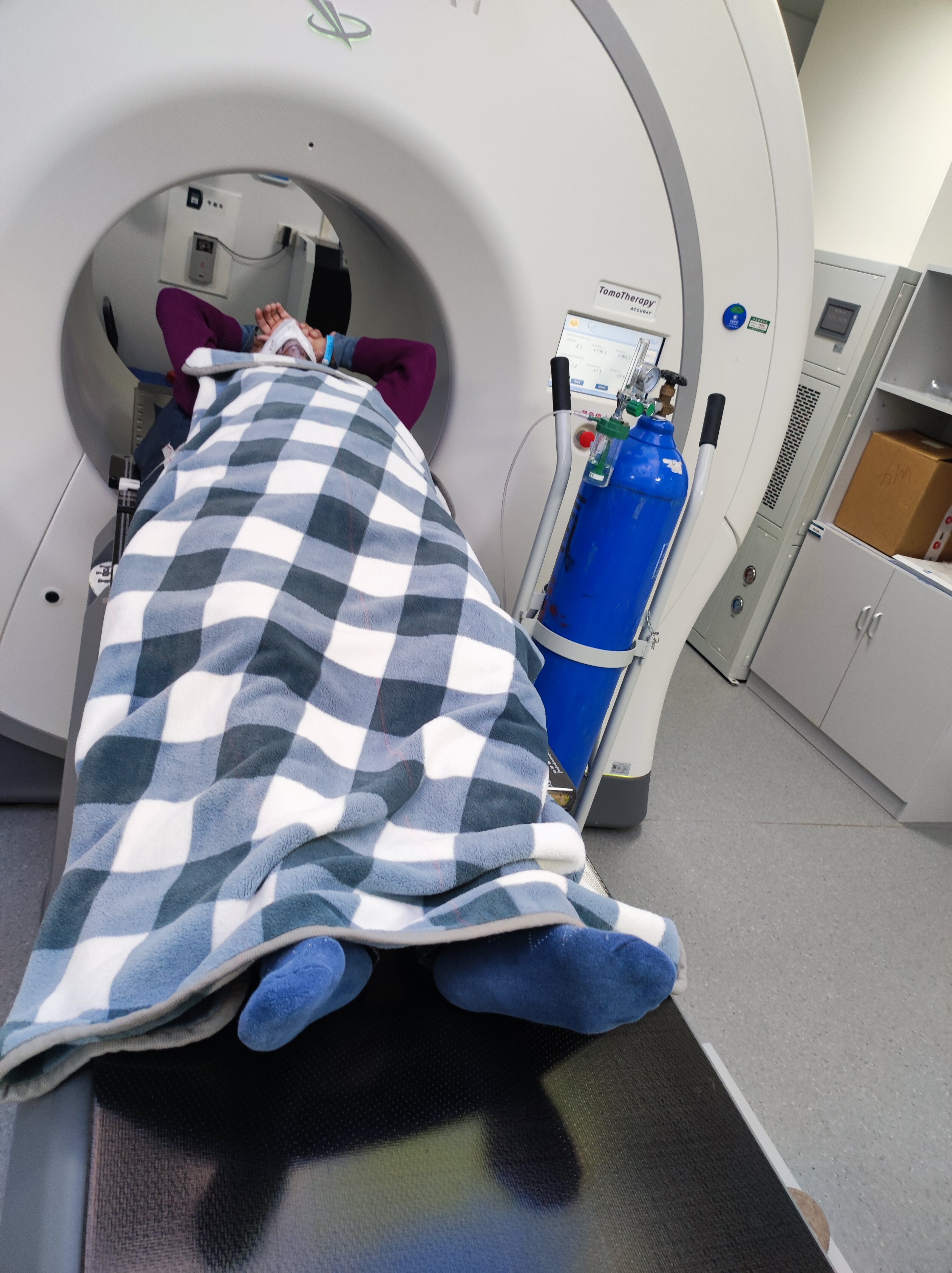 1例(男/87岁)重症新冠肺炎-tom放疗-全肺放疗(单次) 深部热疗(每周2~3