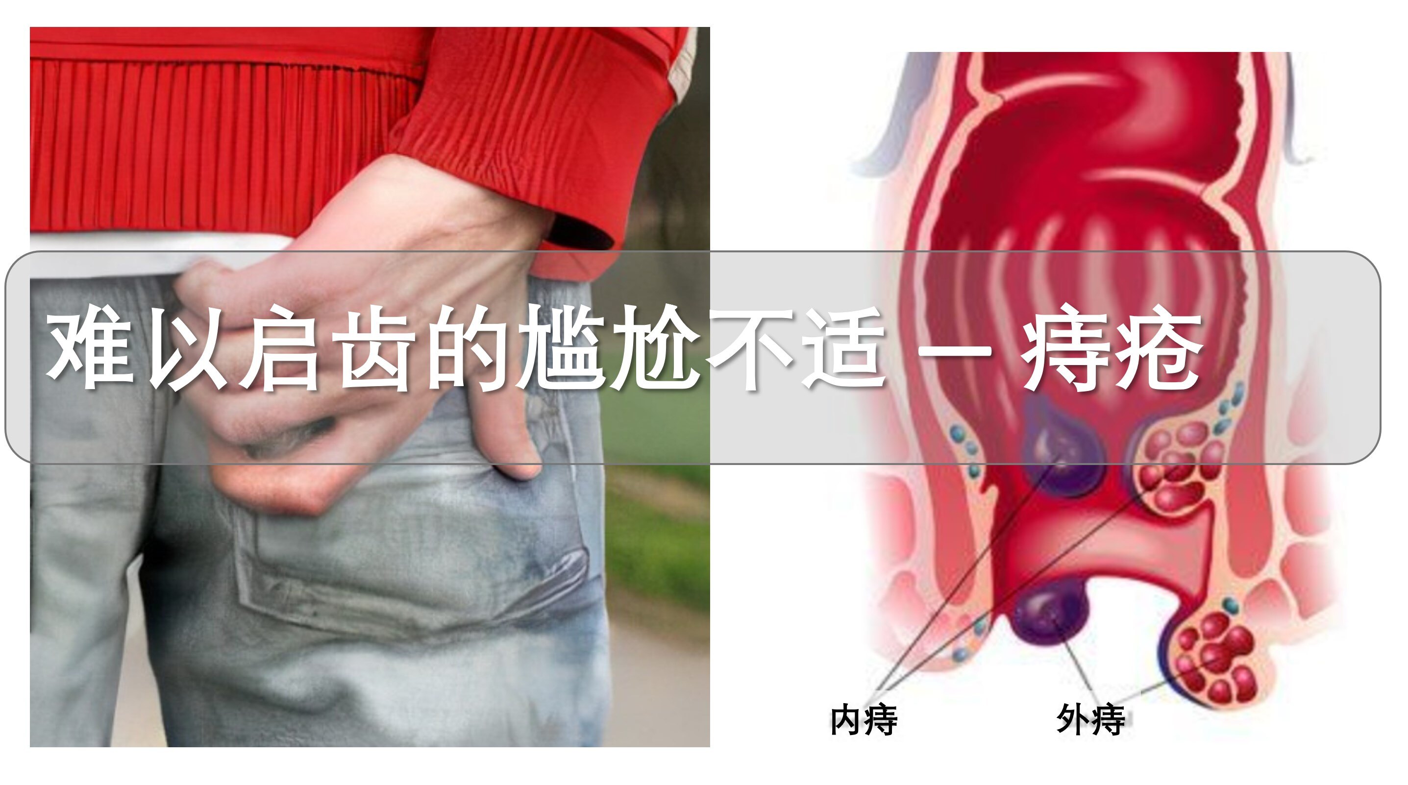 圖文圖片