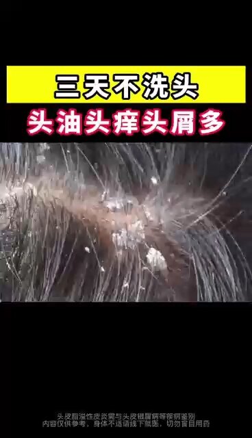 默认图片