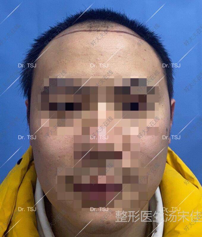 圖文圖片