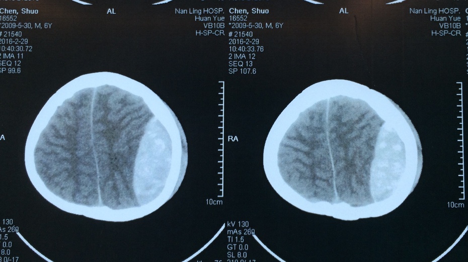 初期手足口病症状最先在哪长_手足口病初期症状图片6_初期手足口病症状图片嘴巴