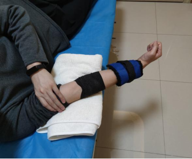 肱骨髁上,髁间,孟氏,桡骨小头,肱骨远端骨折)_骨折_骨折康复锻炼 - 好