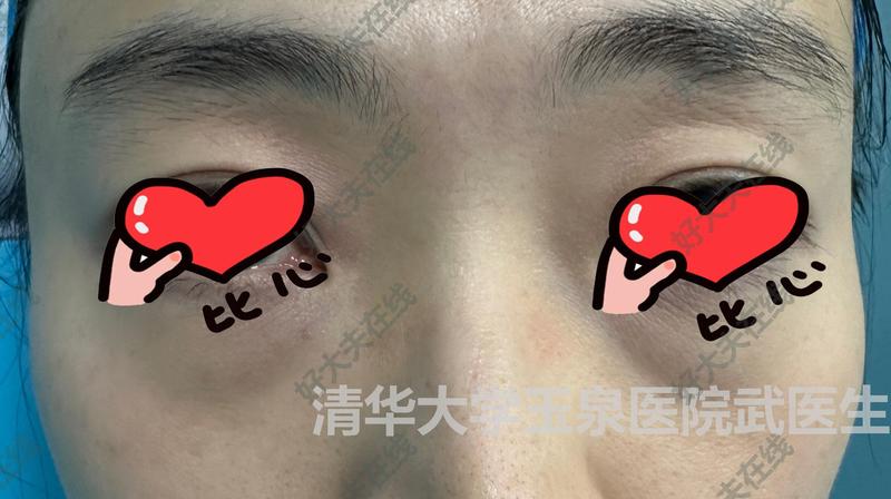 圖文圖片