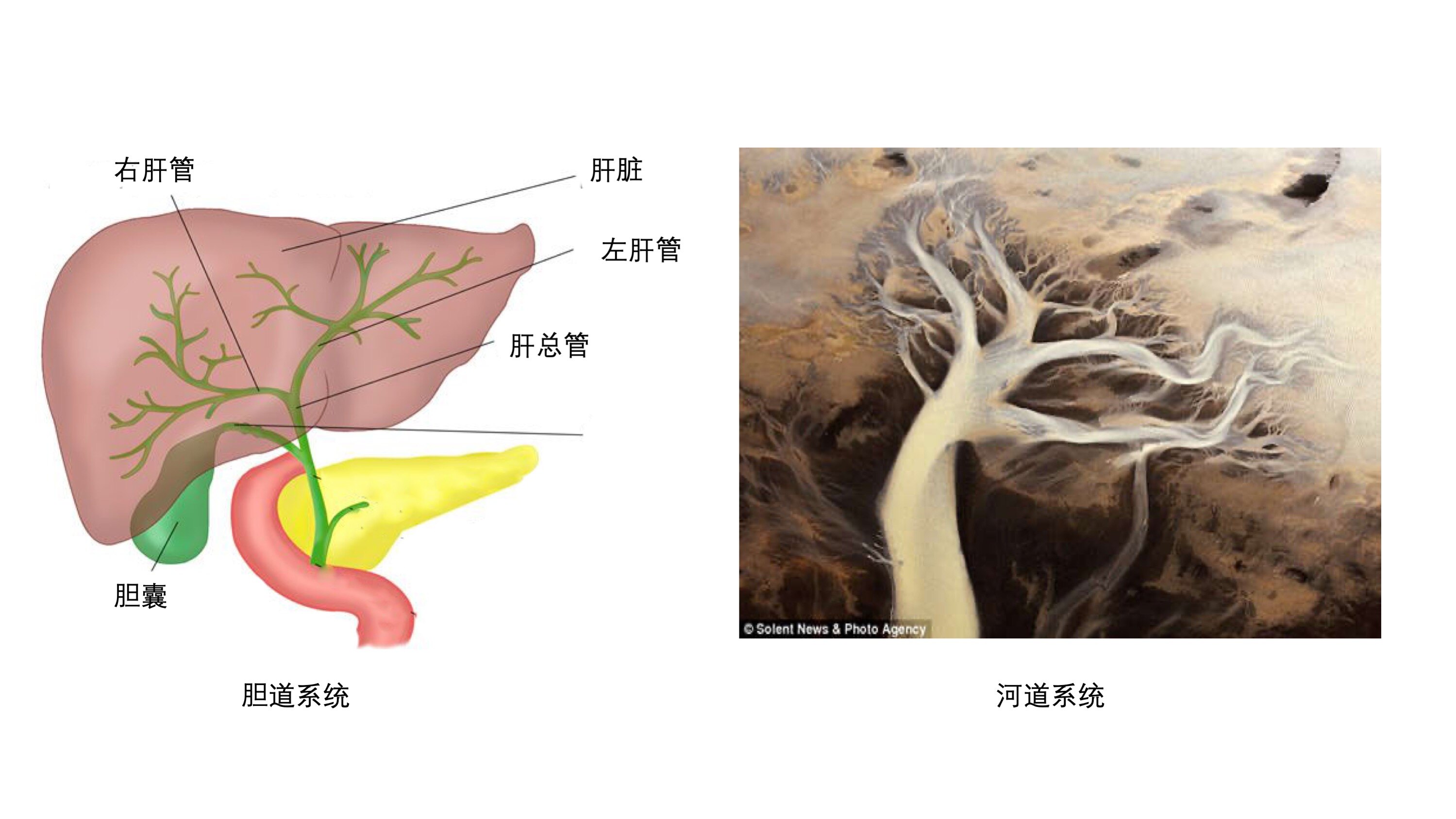 图2-8、9 胆囊结石声像图-腹部超声简易-医学
