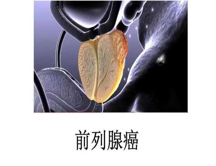 圖文圖片