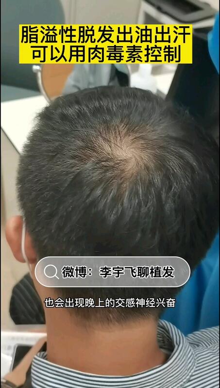 視頻封面