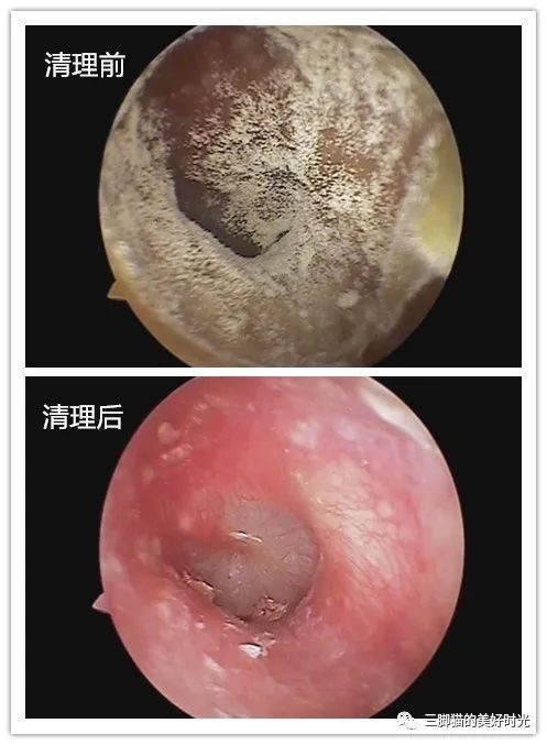 耳道里奇痒可能是长真菌了哦_外耳道真菌病_介绍_发病原因_症状表现