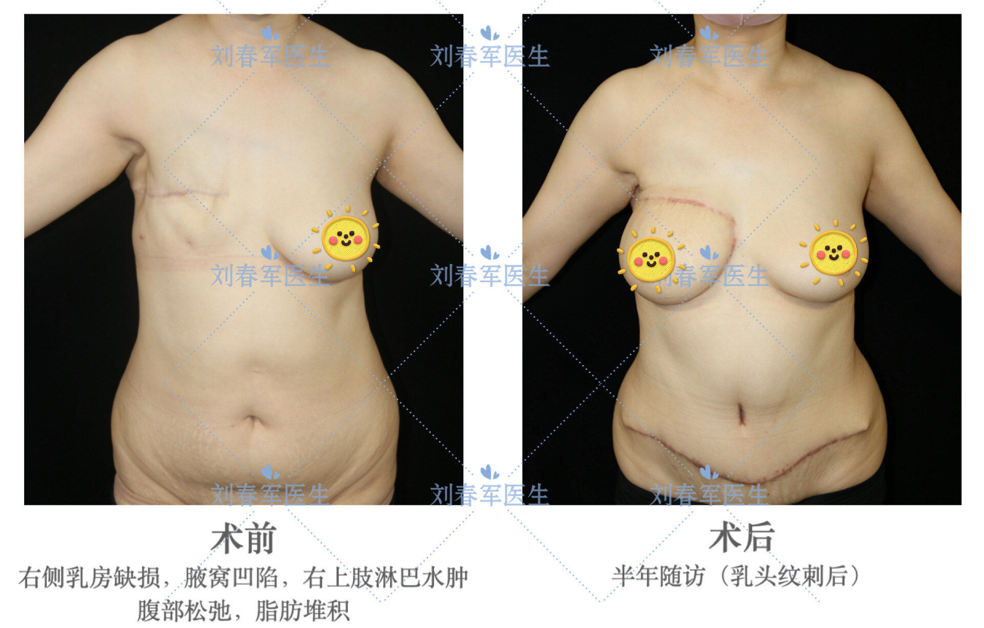 癌症手术后淋巴结肿大怎么办 2IYBAGLT_TOAMxn-AASfO6cKBEI681.jpg?_ms_=30d4