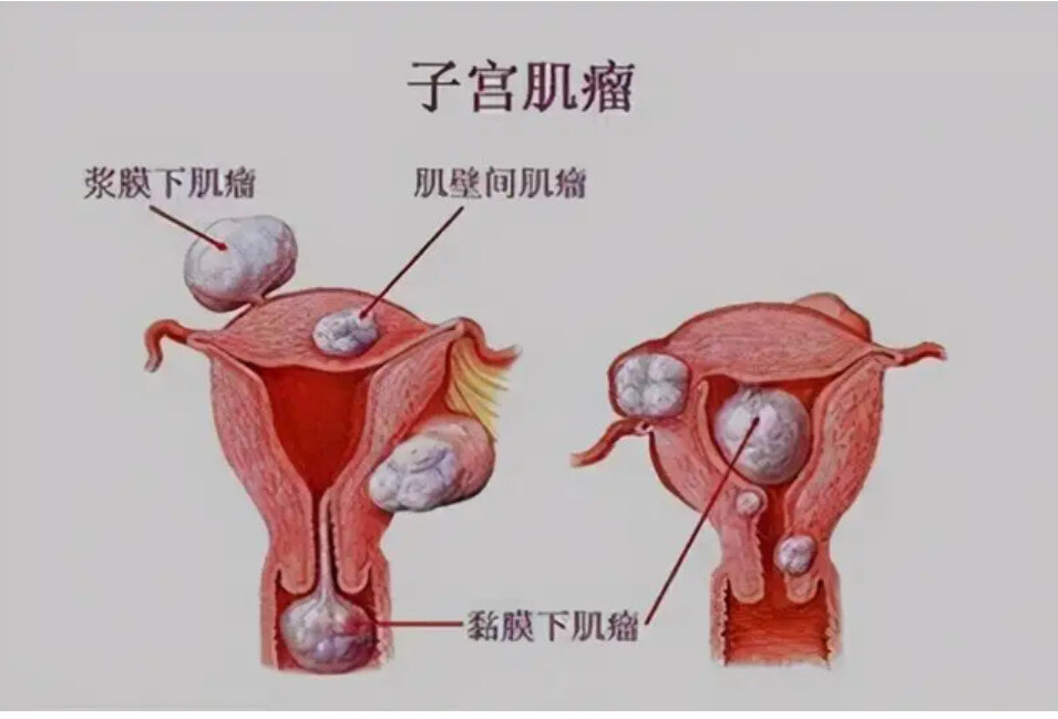 圖文圖片
