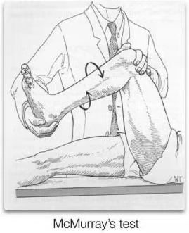 半月板损伤的自查和康复治疗_膝关节半月板损伤_介绍