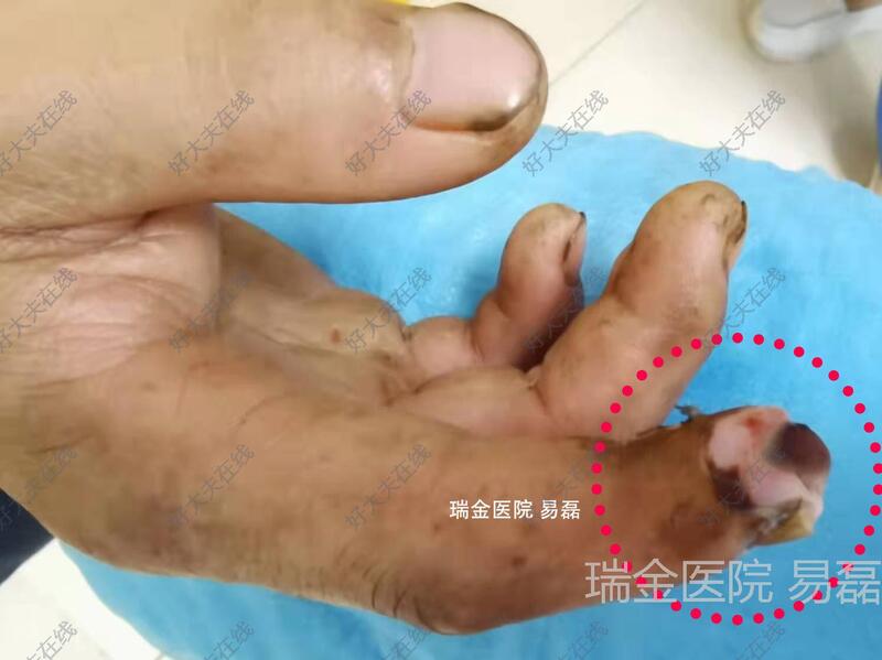 圖文圖片