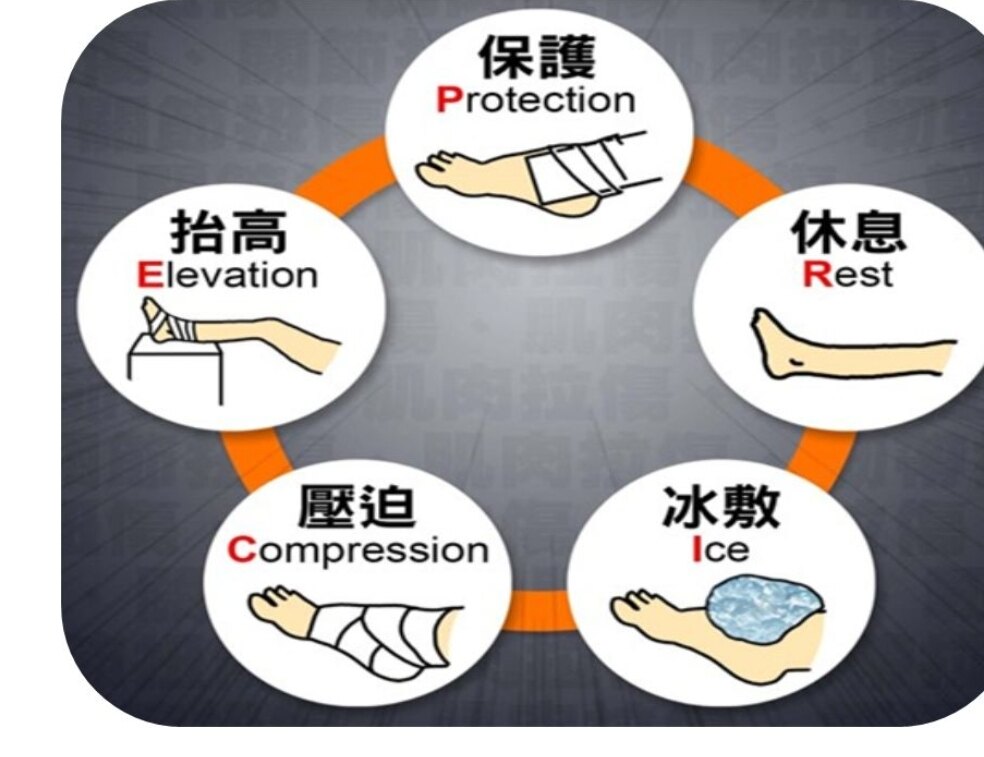 跟腓韧带损伤怎么办图片