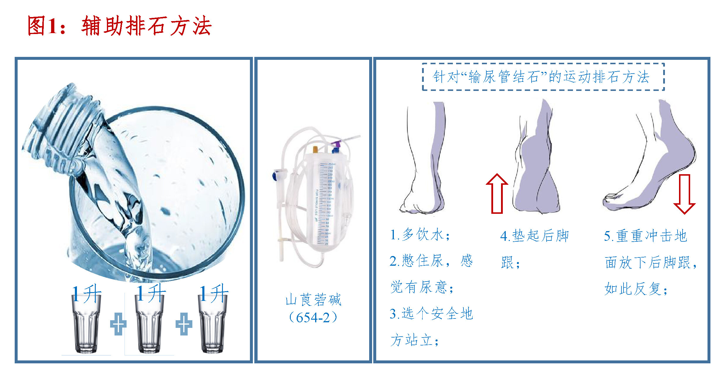 图1：辅助排石方法.jpg