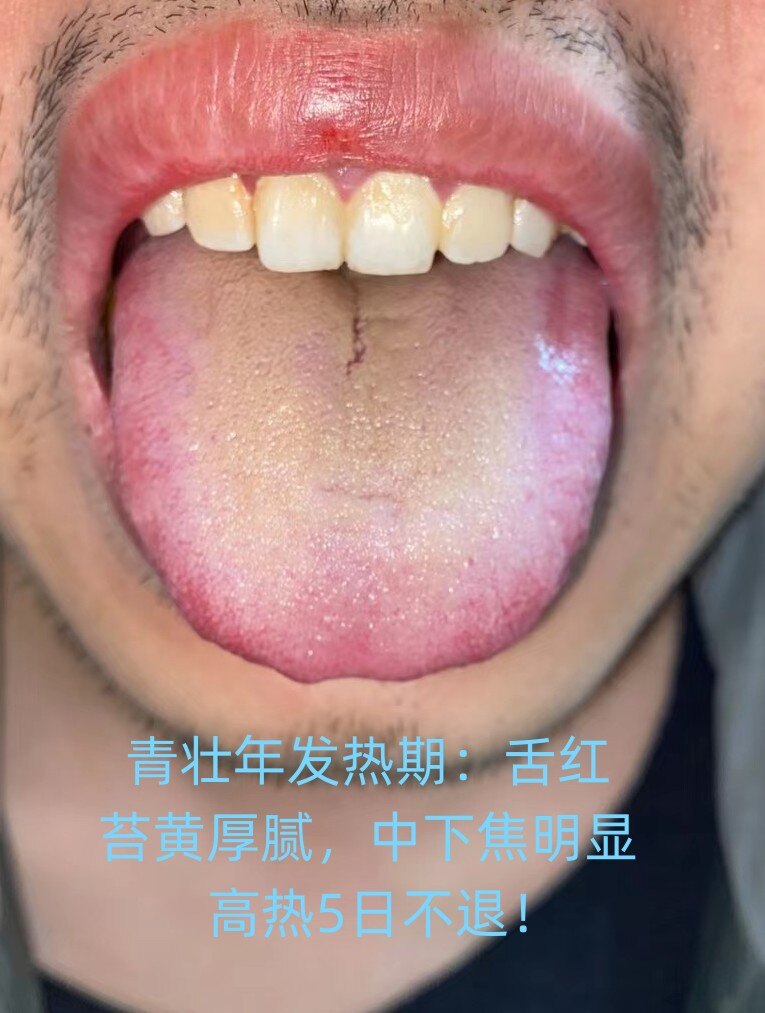 圖文圖片