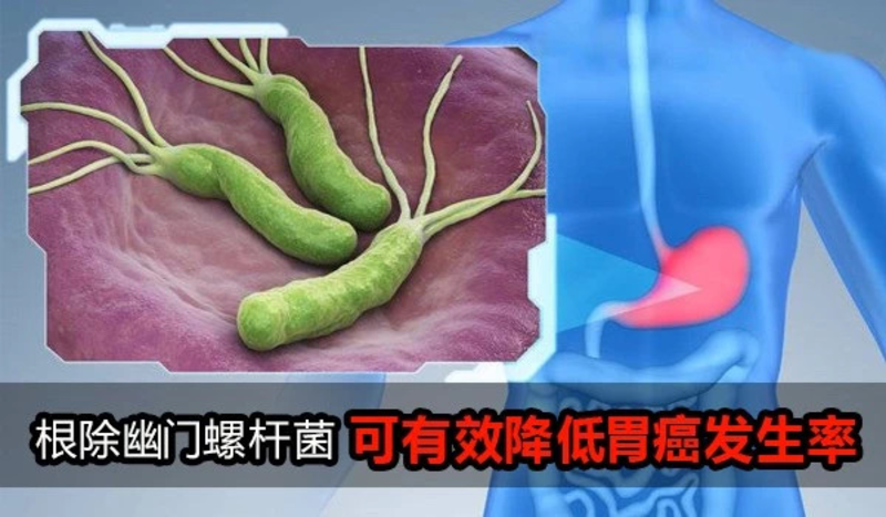 圖文圖片