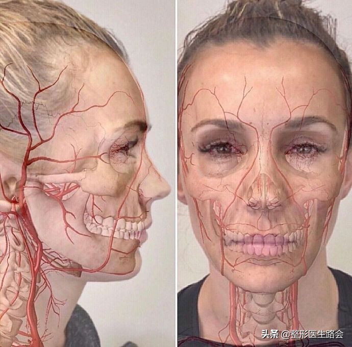应该都知道玻尿酸填充,如果注射不当,在"眼周,太阳穴,鼻部"这些血管