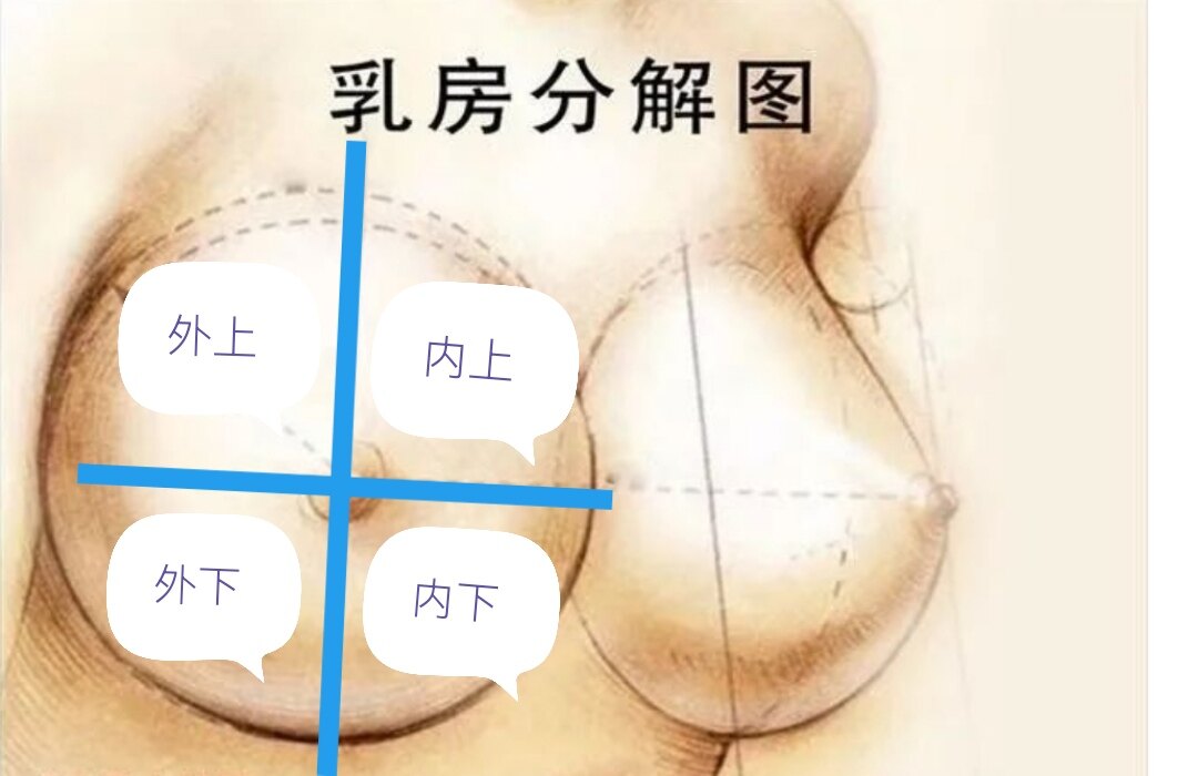 14YBAGFms8CACaG-AAEin0U1MhU399.jpg?_ms_=8f29