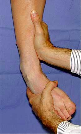 踝关节急性扭伤及关节镜微创踝关节外侧副韧带修补术后康复第三版