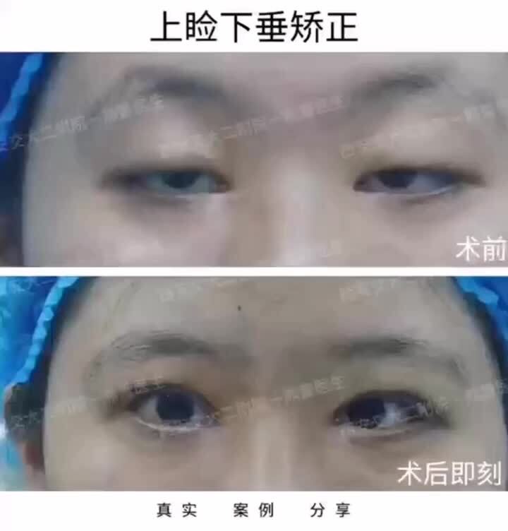 視頻封面