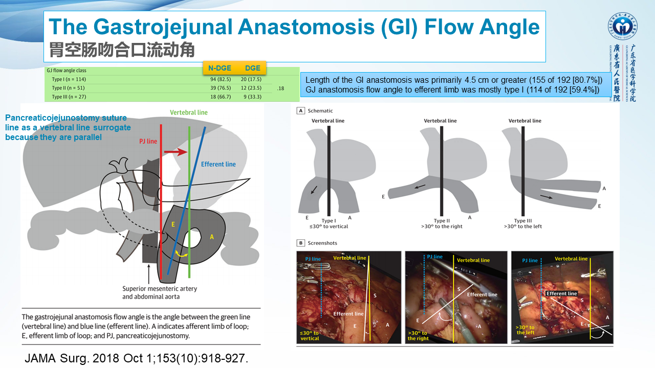 胰十二指肠切除术后胃排空延迟诊治焦点问题