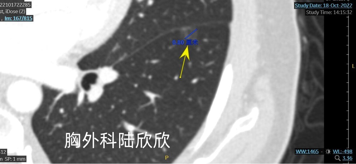 左下1薄层167放大大小水印.jpg