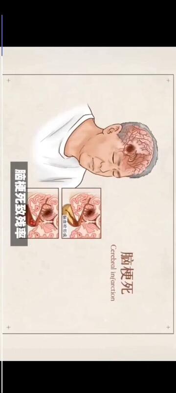 視頻封面
