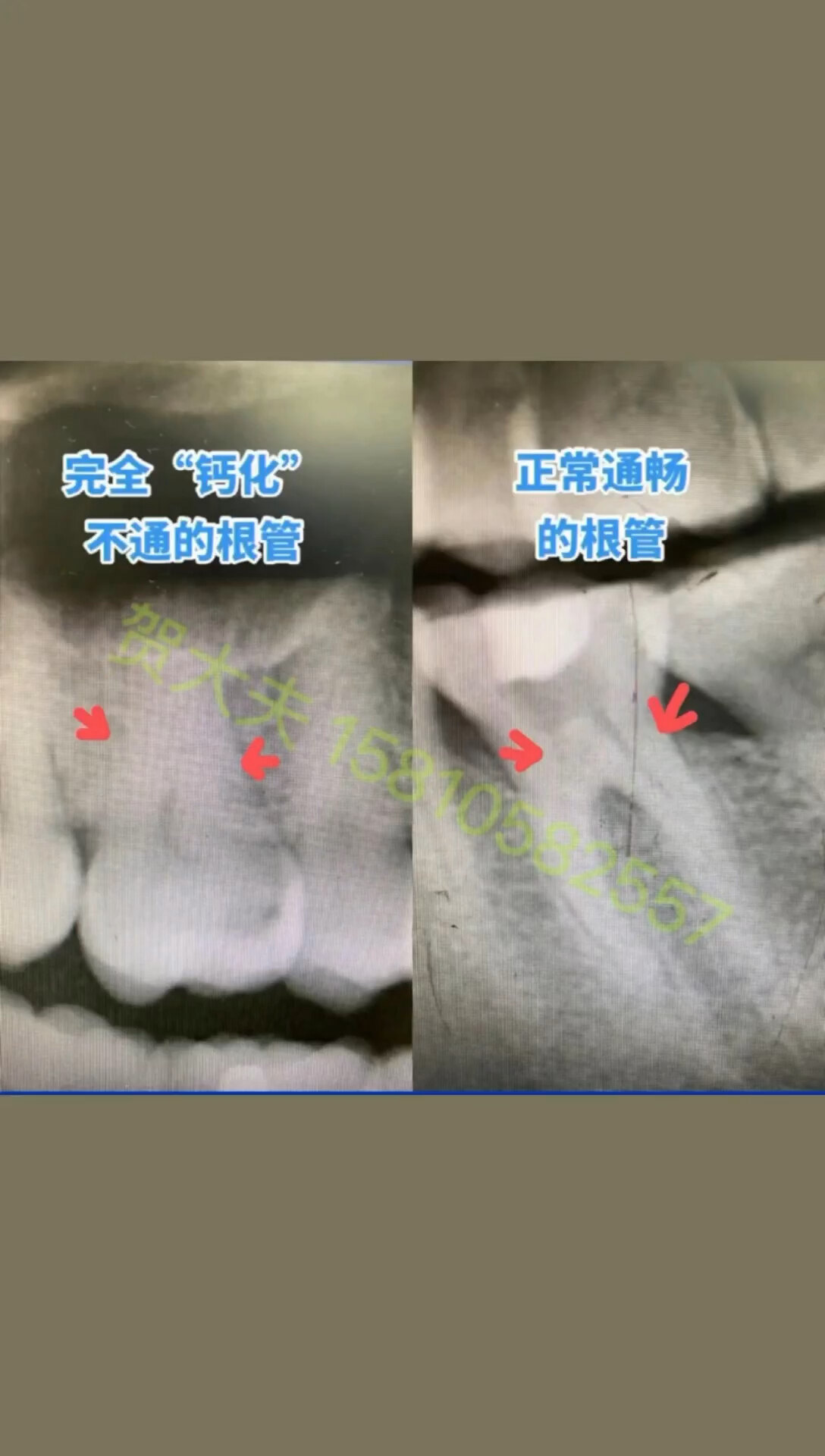 默认图片